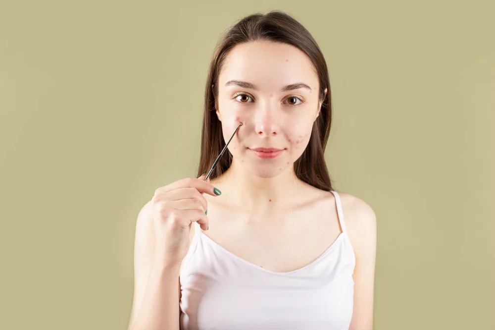 Unpacking the Efficacy and Safety of Essence Skin Tag Removers: A Comprehensive Review